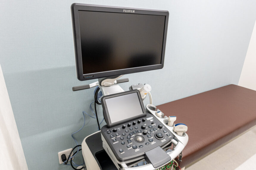 超音波診断装置